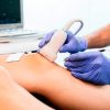Electrolisis-Percutanea (1) Electrolisis-Percutanea